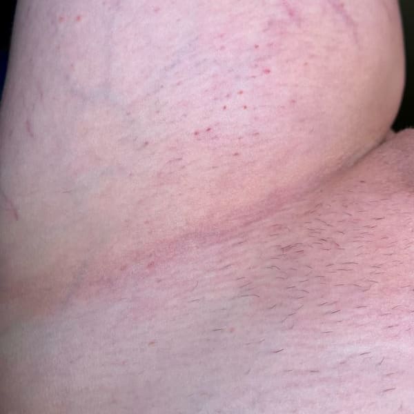 Scars Be Gone Before