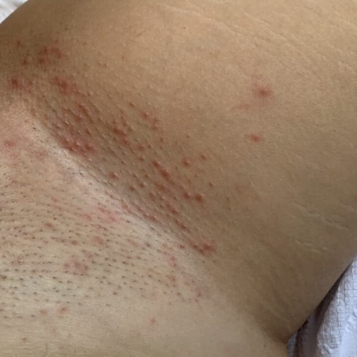 The Ultimate Hair Removal Routine Before