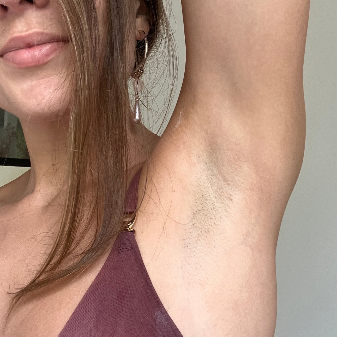 The Ultimate Hair Removal Routine After