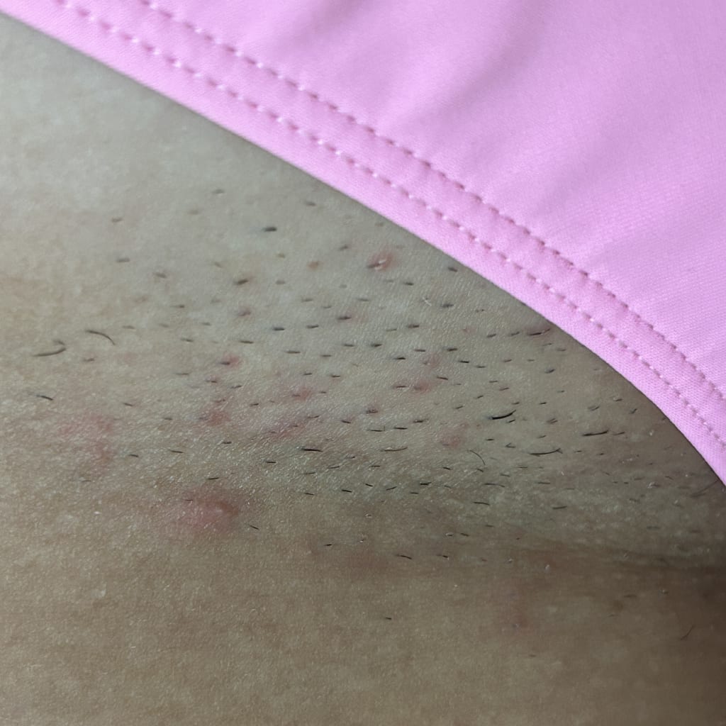 The Ultimate Hair Removal Routine Before