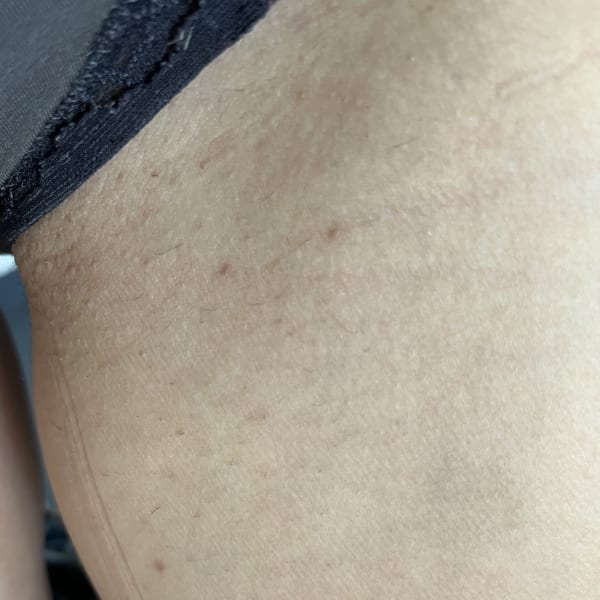 Black Friday Skin Reset Routine After