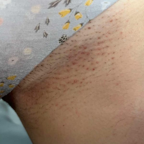 Black Friday Skin Reset Routine Before