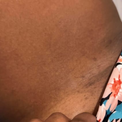 Dark Spots Out After