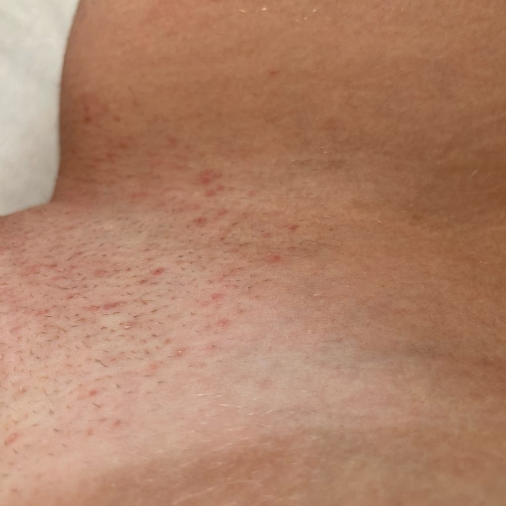 The Ultimate Hair Removal Routine After