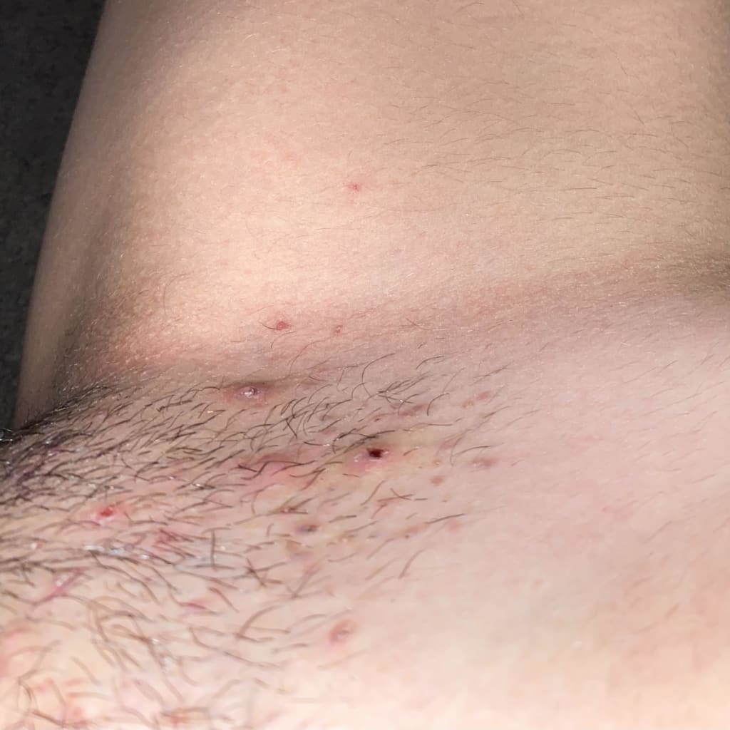The Ultimate Hair Removal Routine Before