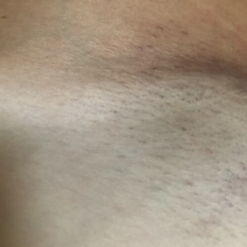 The Complete Intimate Skin Reset After