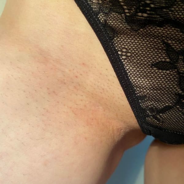 Black Friday Skin Reset Routine After