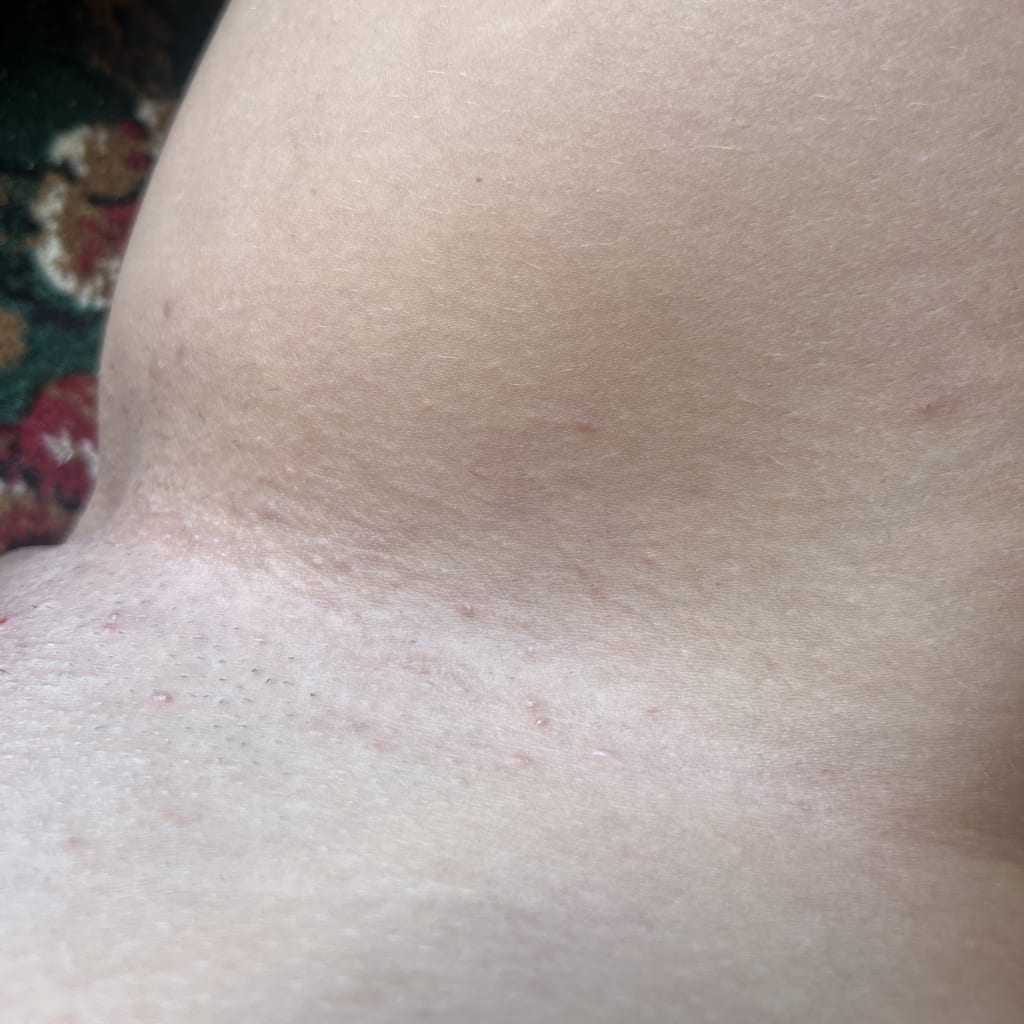 Black Friday Skin Reset Routine After