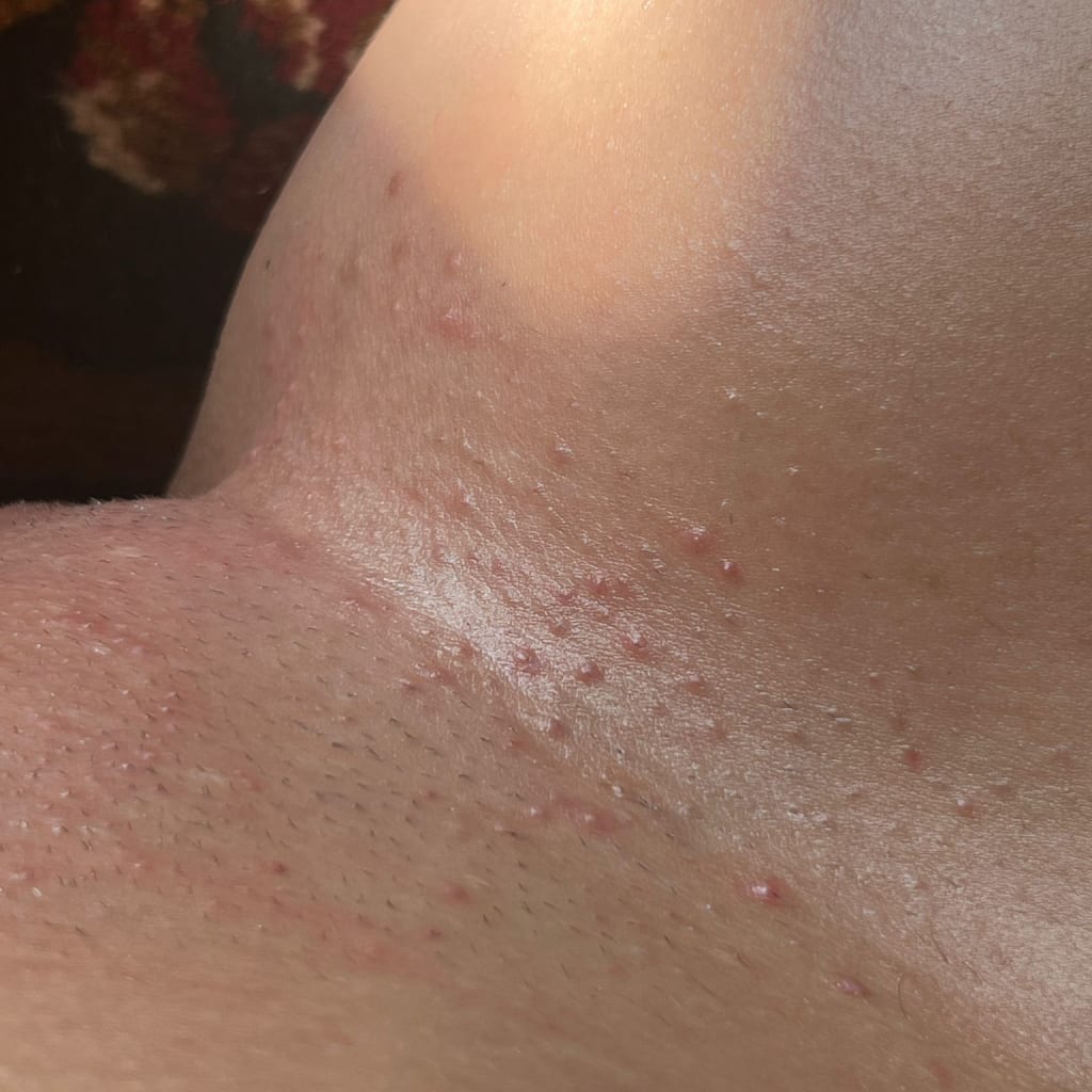 Black Friday Skin Reset Routine Before