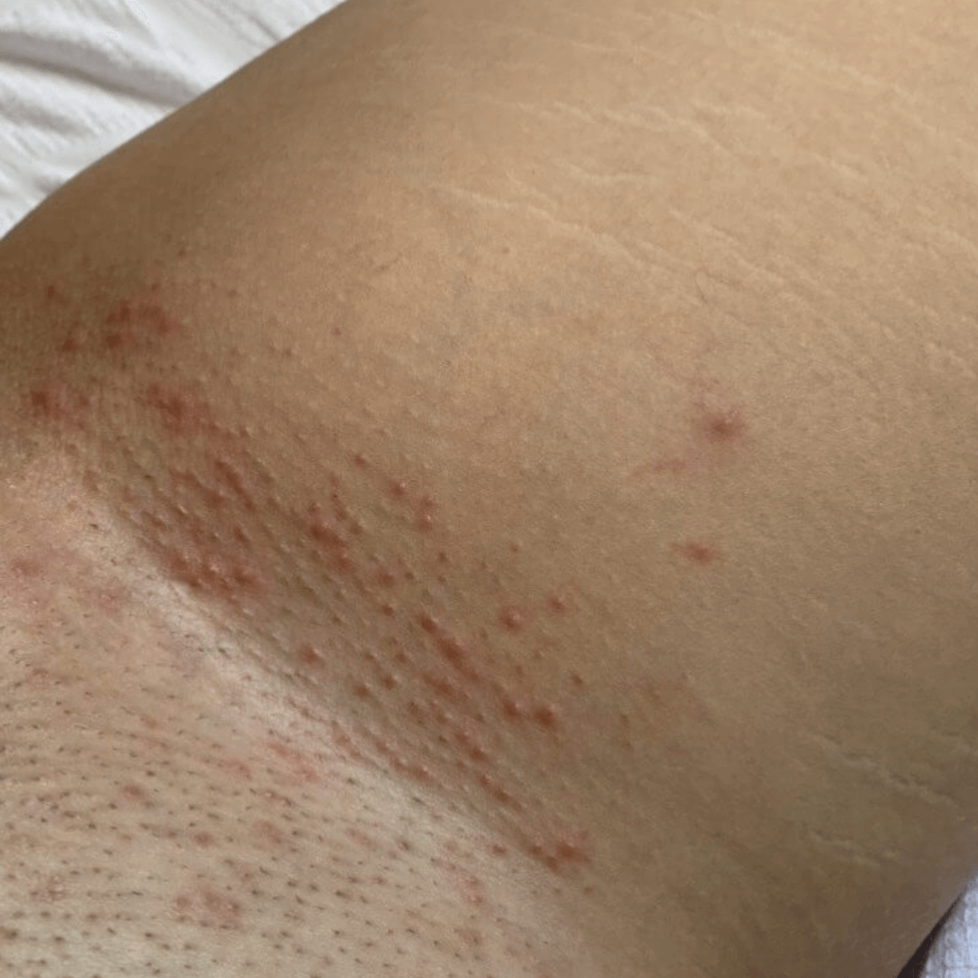 The Ultimate Hair Removal Routine Before