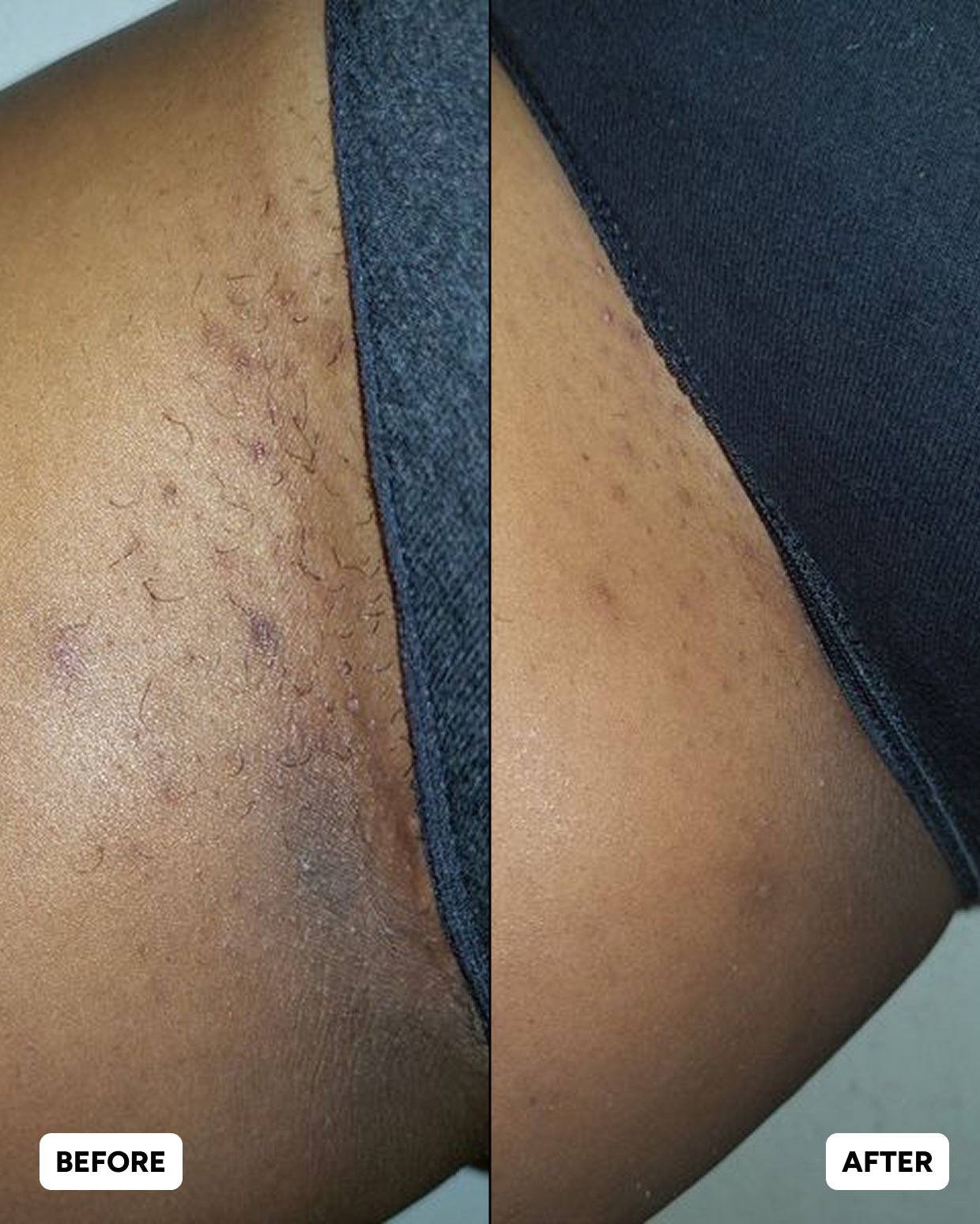 Dark Spots Routine