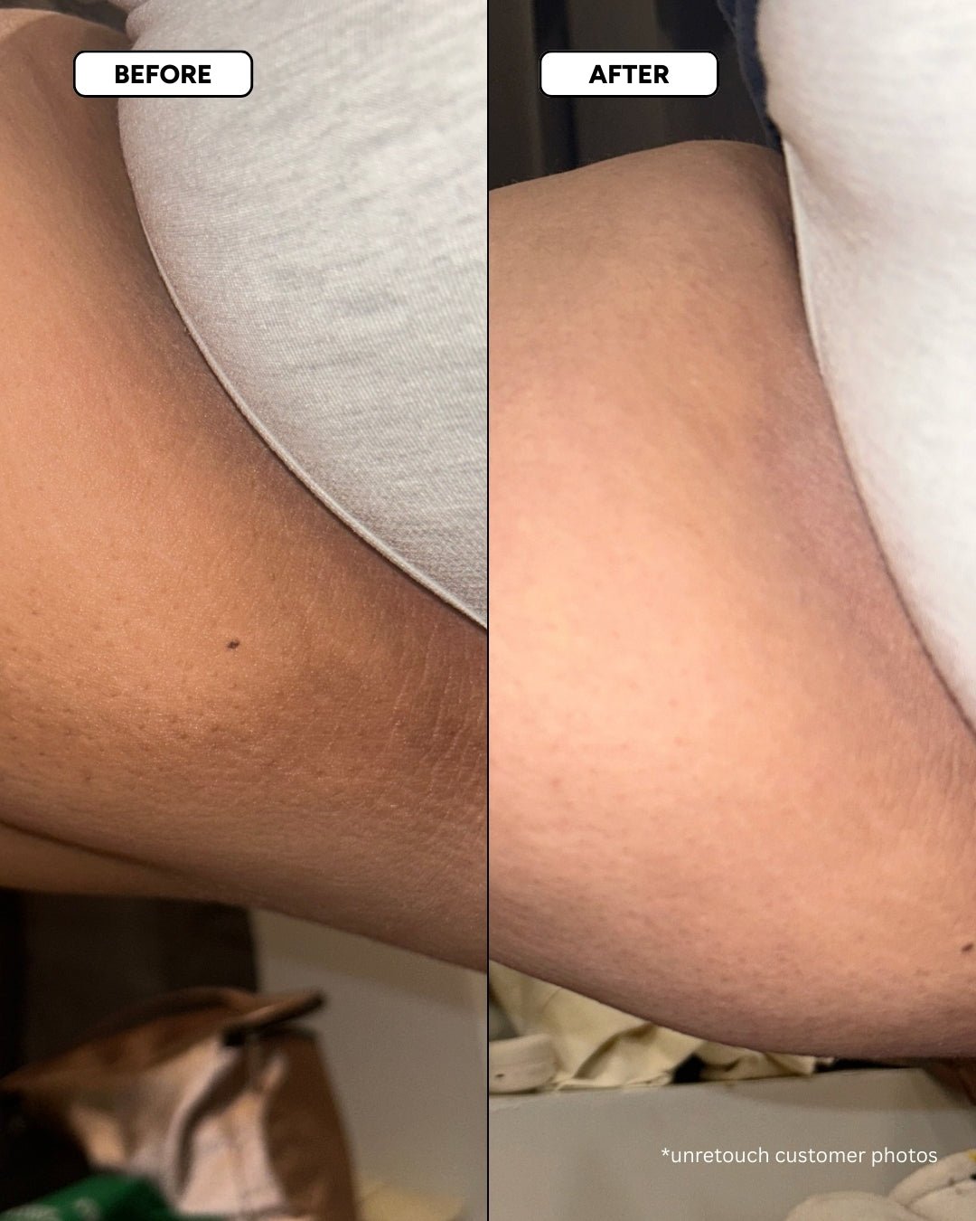 Dark Spots Routine: Glow with Confidence! – Oyo Skincare