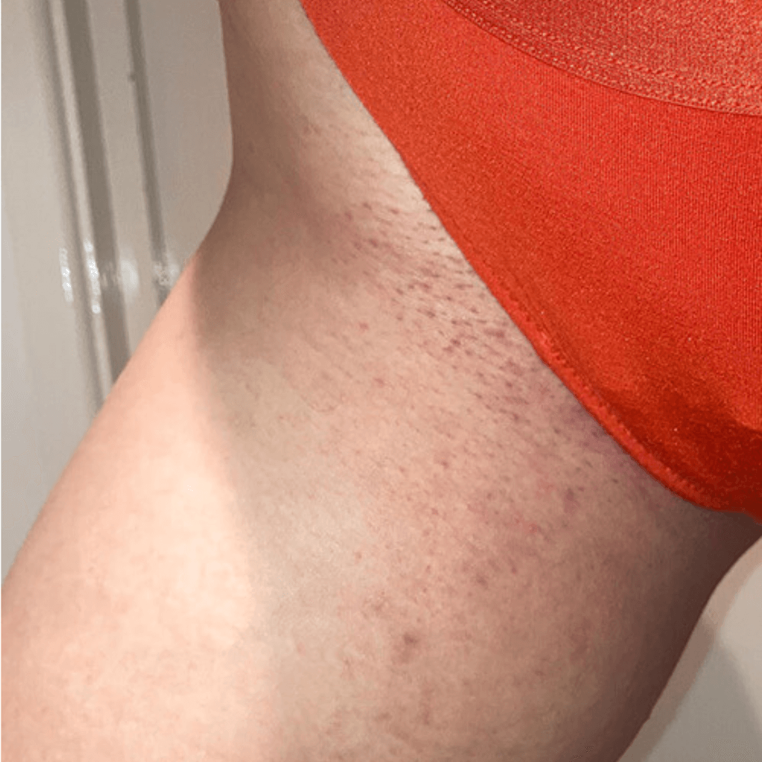 The Ultimate Hair Removal Routine Before