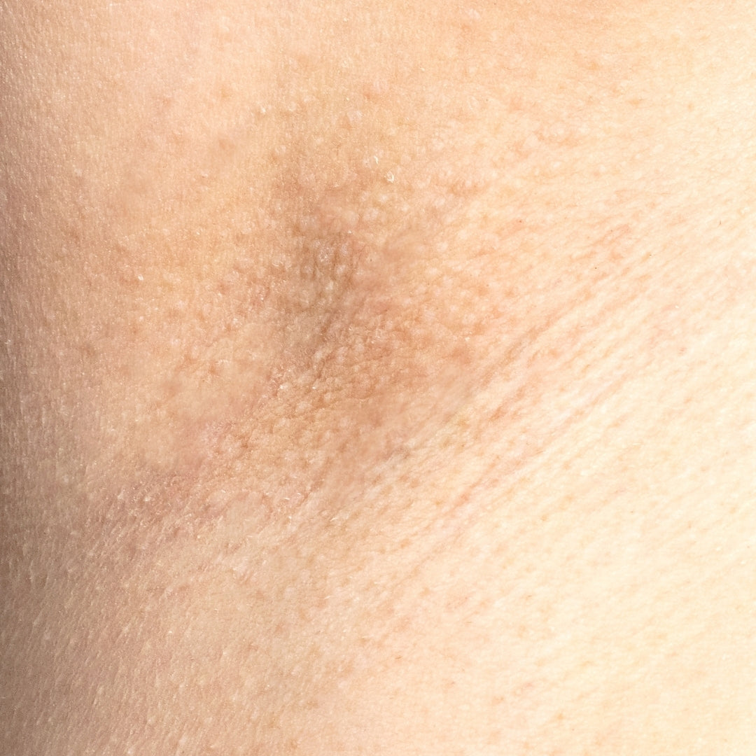 The Intimate IPL Routine Before