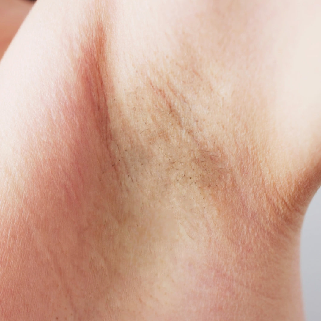 The Intimate IPL Routine After