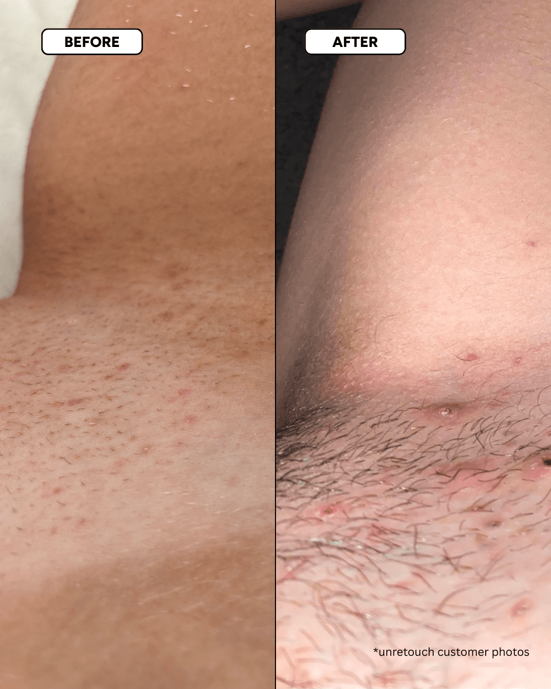 The Smooth Skin System