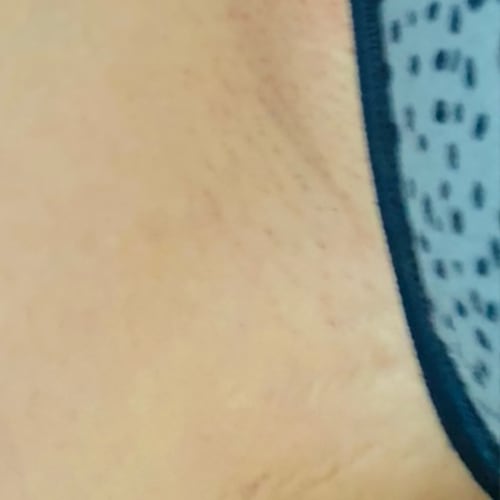 The Complete Intimate Skin Reset After