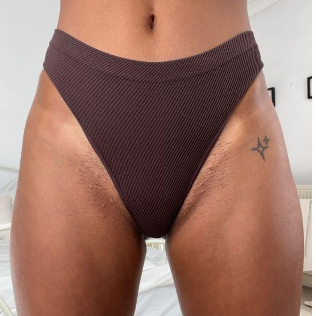The Ultimate Hair Removal Routine Before