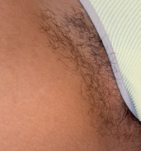 Razor Bumps Routine