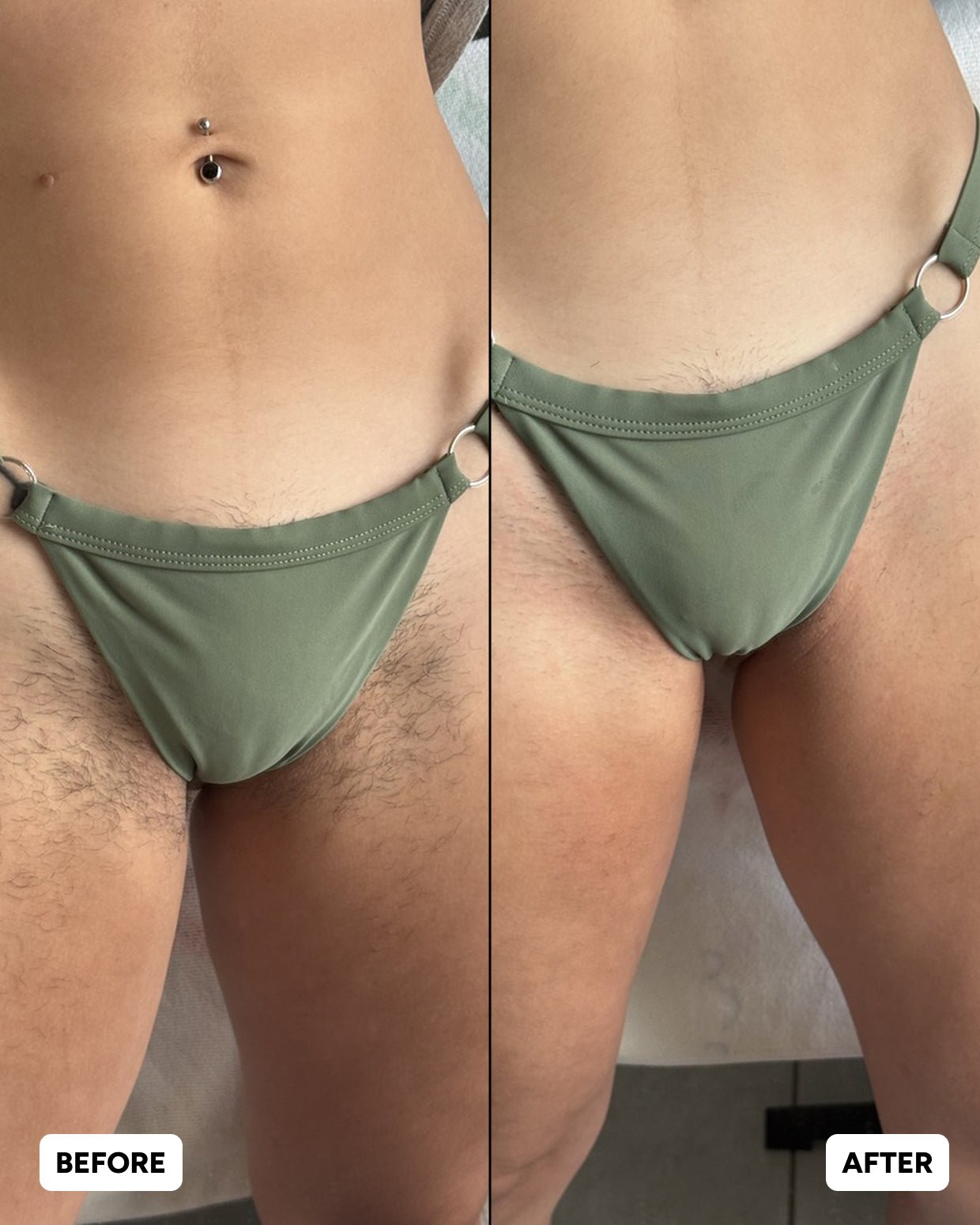 The Ultimate Hair Removal Routine
